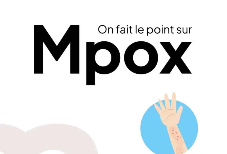 Sud-Kivu : 43 morts à cause de Mpox, les zones de santé de Miti-Murhesa et Nyangezi sont les plus touchées